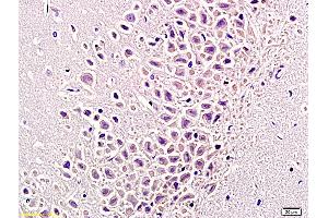 Image no. 3 for anti-Tumor Necrosis Factor alpha (TNF alpha) (AA 181-235) antibody (ABIN677318)