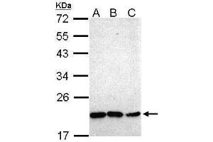 WB Image Sample (30 ug of whole cell lysate) A: Hep G2 , B: Molt-4 , C: Raji 12% SDS PAGE antibody diluted at 1:1000