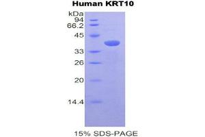 Image no. 1 for Keratin 10 (KRT10) (AA 153-456) protein (His tag) (ABIN1877868)