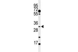 Image no. 2 for anti-Apolipoprotein B mRNA Editing Enzyme, Catalytic Polypeptide-Like 3B (APOBEC3B) (AA 299-330) antibody (ABIN3029993)