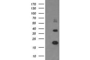 MCTS1 Antikörper  (AA 1-181)