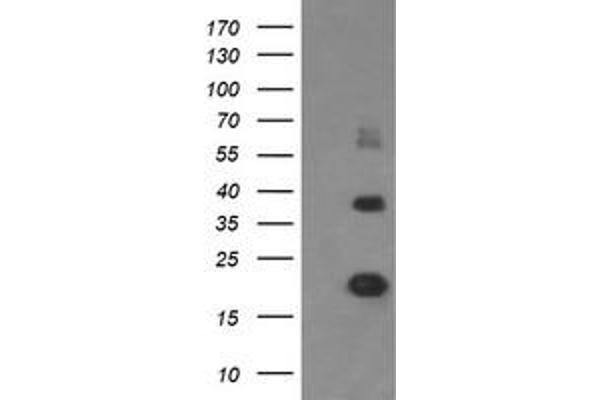 MCTS1 抗体  (AA 1-181)