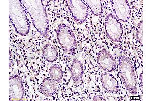 Image no. 1 for anti-Cancer/testis Antigen 2 (CTAG2) (AA 121-210) antibody (ABIN721135)