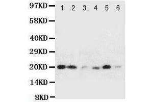 Image no. 1 for anti-Heat Shock 27kDa Protein 2 (HSPB2) (AA 102-118), (Middle Region) antibody (ABIN3044185)