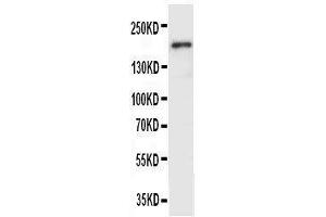 Image no. 4 for anti-VEGF Receptor 2 (VEGFR2) (AA 454-469), (Middle Region) antibody (ABIN3044301)