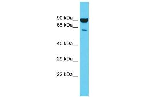 Image no. 1 for anti-N-Myristoyltransferase 2 (NMT2) (C-Term) antibody (ABIN2783450)