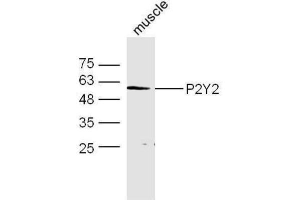 P2RY2 抗体  (AA 21-120)