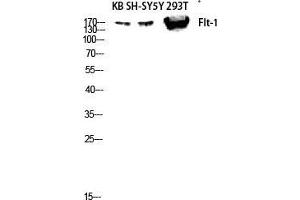 Image no. 1 for anti-Fms-Related tyrosine Kinase 1 (VEGFR1) (FLT1) (Ser385) antibody (ABIN3184639)