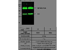 Image no. 1 for anti-Nucleoside Phosphorylase (NP) (AA 1-289) antibody (ABIN1999547)