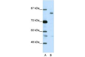 Image no. 1 for anti-Leucine-Zipper-Like Transcription Regulator 1 (LZTR1) (C-Term) antibody (ABIN925909)