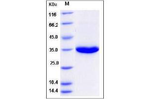 Image no. 1 for Prostate Specific Antigen (PSA) (AA 1-261) (Active) protein (His tag) (ABIN2003371)
