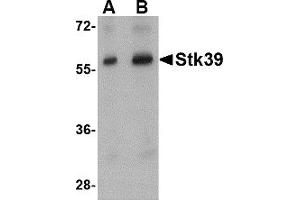Image no. 1 for anti-serine threonine Kinase 39 (STK39) (Middle Region) antibody (ABIN1031111)