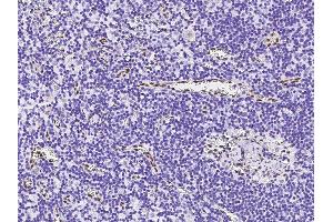 Image no. 2 for anti-Promyelocytic Leukemia (PML) (N-Term) antibody (ABIN6924426)