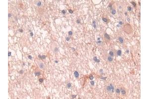 Image no. 3 for anti-Parathyroid Hormone 1 Receptor (PTH1R) (AA 28-188) antibody (ABIN1870093)