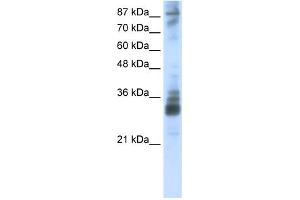 Image no. 1 for anti-RNA (Guanine-9-) Methyltransferase Domain Containing 2 (RG9MTD2) (Middle Region) antibody (ABIN2776647)