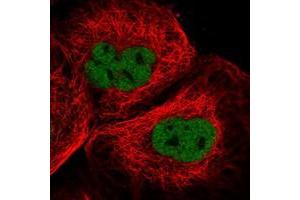 Image no. 1 for anti-Cancer Susceptibility Candidate 5 (CASC5) antibody (ABIN5573743)