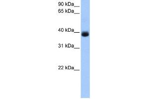 Image no. 1 for anti-serpin Peptidase Inhibitor, Clade A (Alpha-1 Antiproteinase, Antitrypsin), Member 5 (SERPINA5) (C-Term) antibody (ABIN2785440)