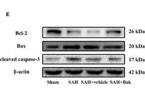 Image no. 1 for anti-Actin, beta (ACTB) antibody (ABIN3020547)