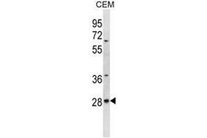 Image no. 1 for anti-AlkB, Alkylation Repair Homolog 4 (E. Coli) (ALKBH4) (AA 95-125), (Middle Region) antibody (ABIN950352)