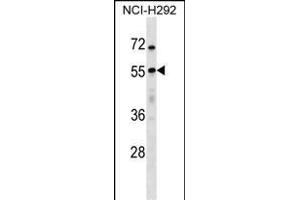 USP27X Antibody (N-term) (ABIN1538806 and ABIN2848554) western blot analysis in NCI- cell line lysates (35 μg/lane).