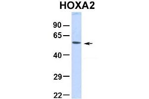 Image no. 2 for anti-Homeobox A2 (HOXA2) (Middle Region) antibody (ABIN2780802)