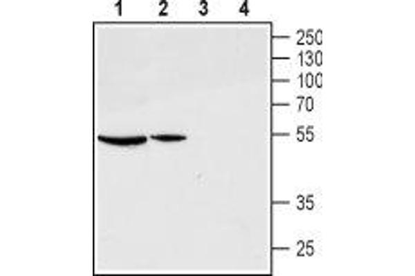 GNRHR anticorps  (Extracellular, N-Term)