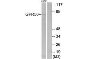 Image no. 2 for anti-G Protein-Coupled Receptor 56 (GPR56) (AA 251-300) antibody (ABIN1535746)