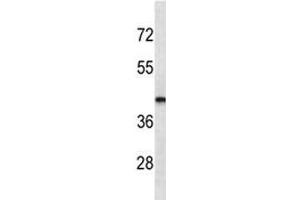 Image no. 2 for anti-LIM Homeobox 2 (LHX2) antibody (ABIN3028803)