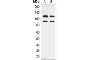 Image no. 1 for anti-Cyclin-Dependent Kinase 11B (CDK11B) (N-Term) antibody (ABIN2801432)