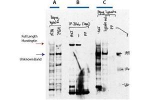 Western blot analysis after AKT and phosphatase treatment is shown using  Affinity Purified anti-Huntingtin pS421 antibody.