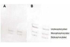 anti-Myosin, Light Chain 12A, Regulatory, Non-Sarcomeric (MYL12A) (pSer19), (pSer20) antibody