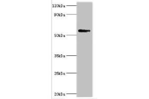 Western blot All lanes: Bromodomain-containing protein 9 antibody at 2 μg/mL + Mouse liver tissue Secondary Goat polyclonal to rabbit IgG at 1/10000 dilution Predicted band size: 68, 23, 54, 27, 56, 61 kDa Observed band size: 68 kDa