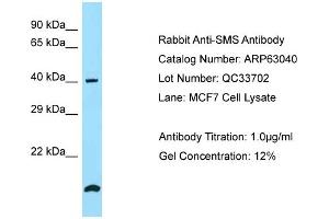 Image no. 1 for anti-Spermine Synthase, SMS (SMS) (N-Term) antibody (ABIN2789345)