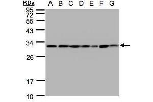 Image no. 1 for anti-14-3-3 theta (YWHAQ) (Center) antibody (ABIN2855319)