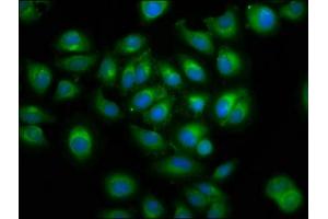 Immunofluorescence staining of A549 cells with ABIN7165321 at 1:100, counter-stained with DAPI.