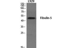 Image no. 2 for anti-Fibulin 5 (FBLN5) (Internal Region) antibody (ABIN3184623)