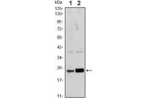 Image no. 2 for anti-RAB10, Member RAS Oncogene Family (RAB10) antibody (ABIN1108802)