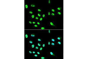 Image no. 2 for anti-Fc Fragment of IgG, Low Affinity IIa, Receptor (CD32) (FCGR2A) antibody (ABIN1512904)