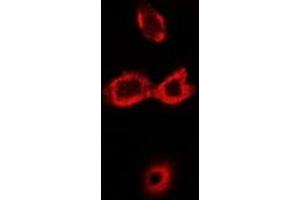 Image no. 1 for anti-Solute Carrier Family 7 (Cationic Amino Acid Transporter, Y+ System), Member 1 (SLC7A1) antibody (ABIN2966498)