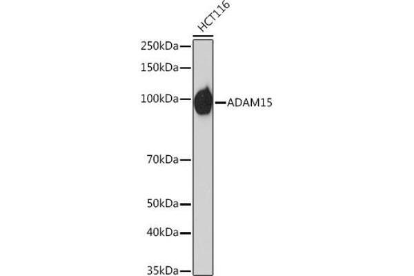 ADAM15 抗体