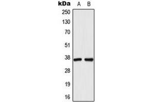 Image no. 2 for anti-Dihydrodiol Dehydrogenase (DDH) (N-Term) antibody (ABIN2707318)