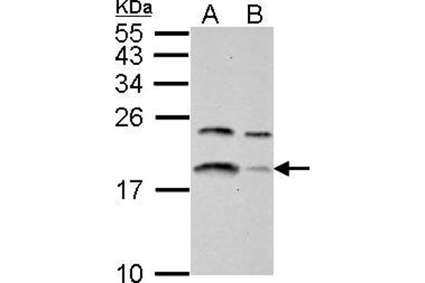 LC3B antibody  (full length)