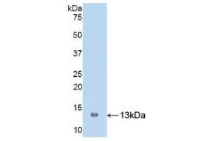 Image no. 4 for S100 Calcium Binding Protein A8 (S100A8) ELISA Kit (ABIN6574287)