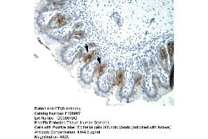 Image no. 2 for anti-Ets Variant 6 (ETV6) (C-Term) antibody (ABIN2792592)