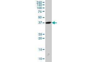Image no. 2 for anti-Endophilin-A1 (SH3G2) (AA 64-124) antibody (ABIN562863)