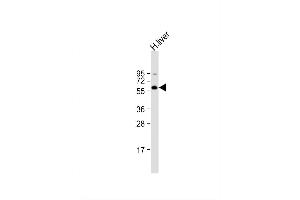 Image no. 2 for anti-Complement Component C9 (C9) (AA 191-220), (Center) antibody (ABIN657704)