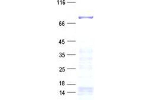 rho GTPase Activating Protein 24 (ARHGAP24) protein (His tag)