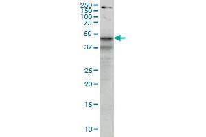Image no. 1 for anti-Sex Hormone Binding Globulin (SHBG) (AA 41-140) antibody (ABIN562865)