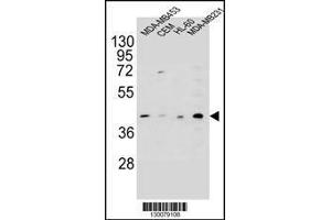 Image no. 3 for anti-HERV-H LTR-Associating 2 (HHLA2) (AA 58-87) antibody (ABIN654607)