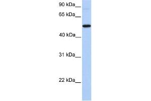 Image no. 1 for anti-UDP-N-Acetyl-alpha-D-Galactosamine:polypeptide N-Acetylgalactosaminyltransferase 13 (GalNAc-T13) (GALNT13) (N-Term) antibody (ABIN2784100)